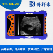 大屏牛用B超测孕仪BXL-V50