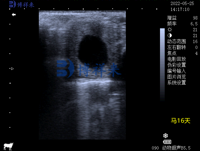 马怀孕16天B超图像