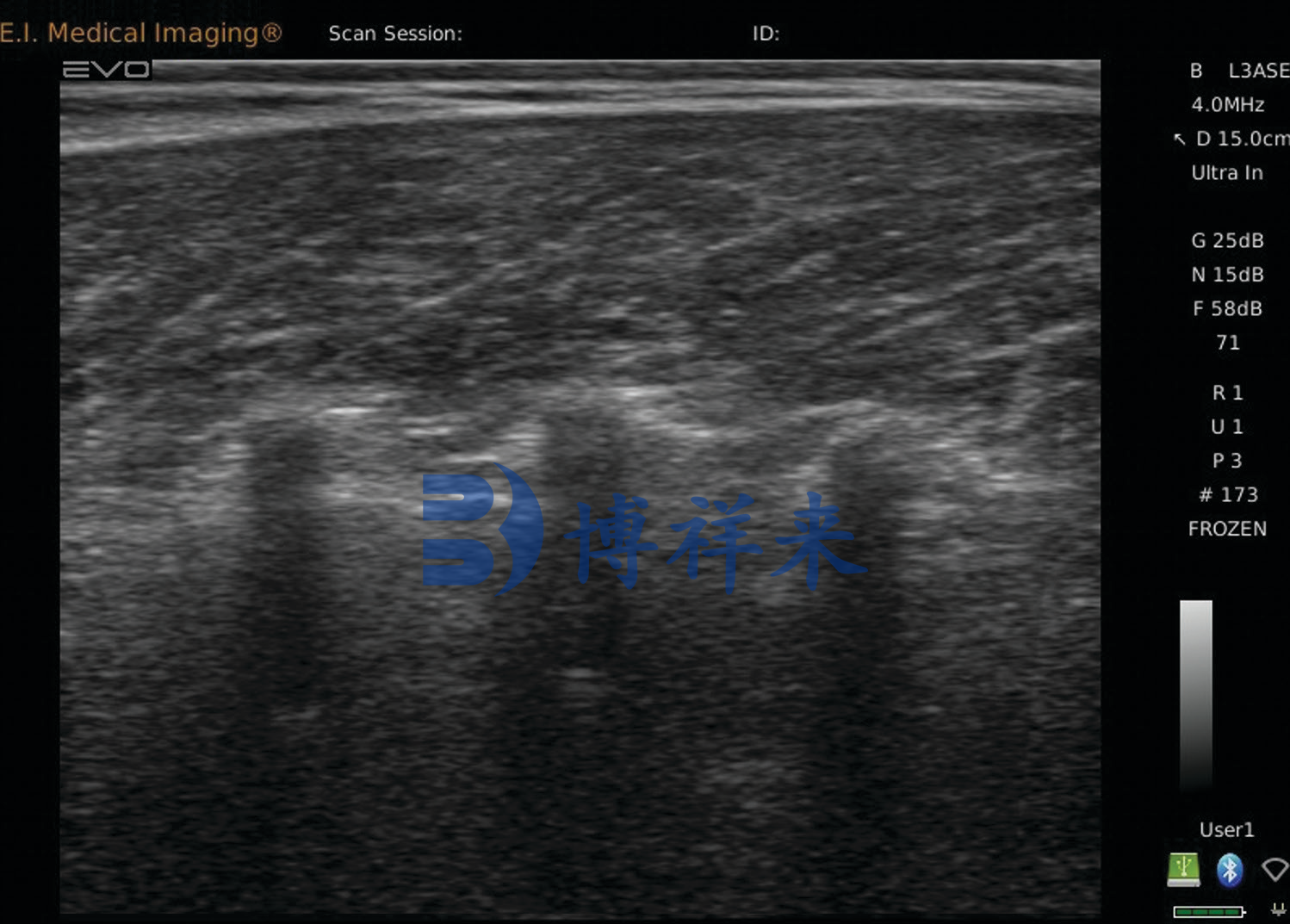 肉牛肌内脂肪含量的智能检测正在改变育种方式