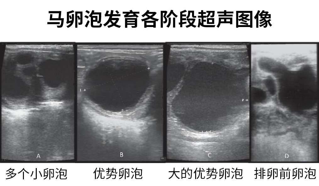 马各阶段卵泡超声图像