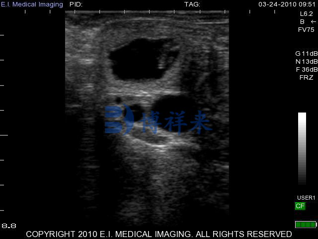 直肠探头测牛34天超声图