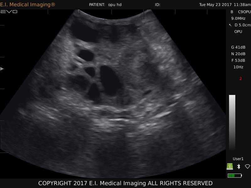 牛卵泡超声图像 牛卵泡超声图像