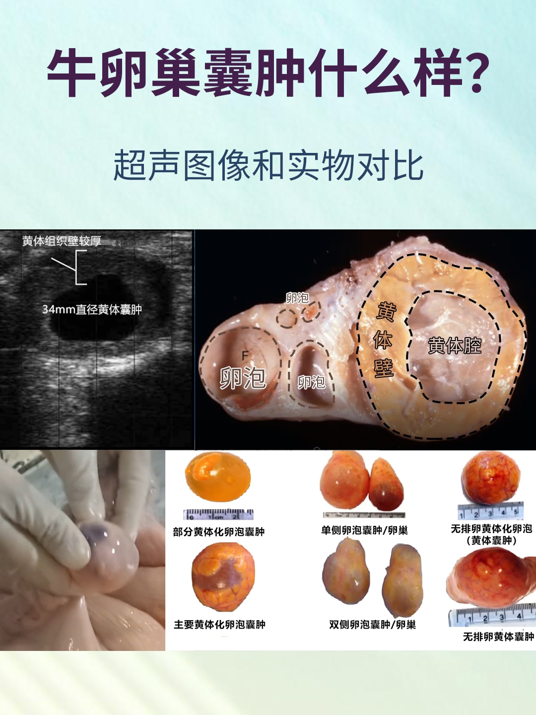 牛卵巢囊肿超声实物对比