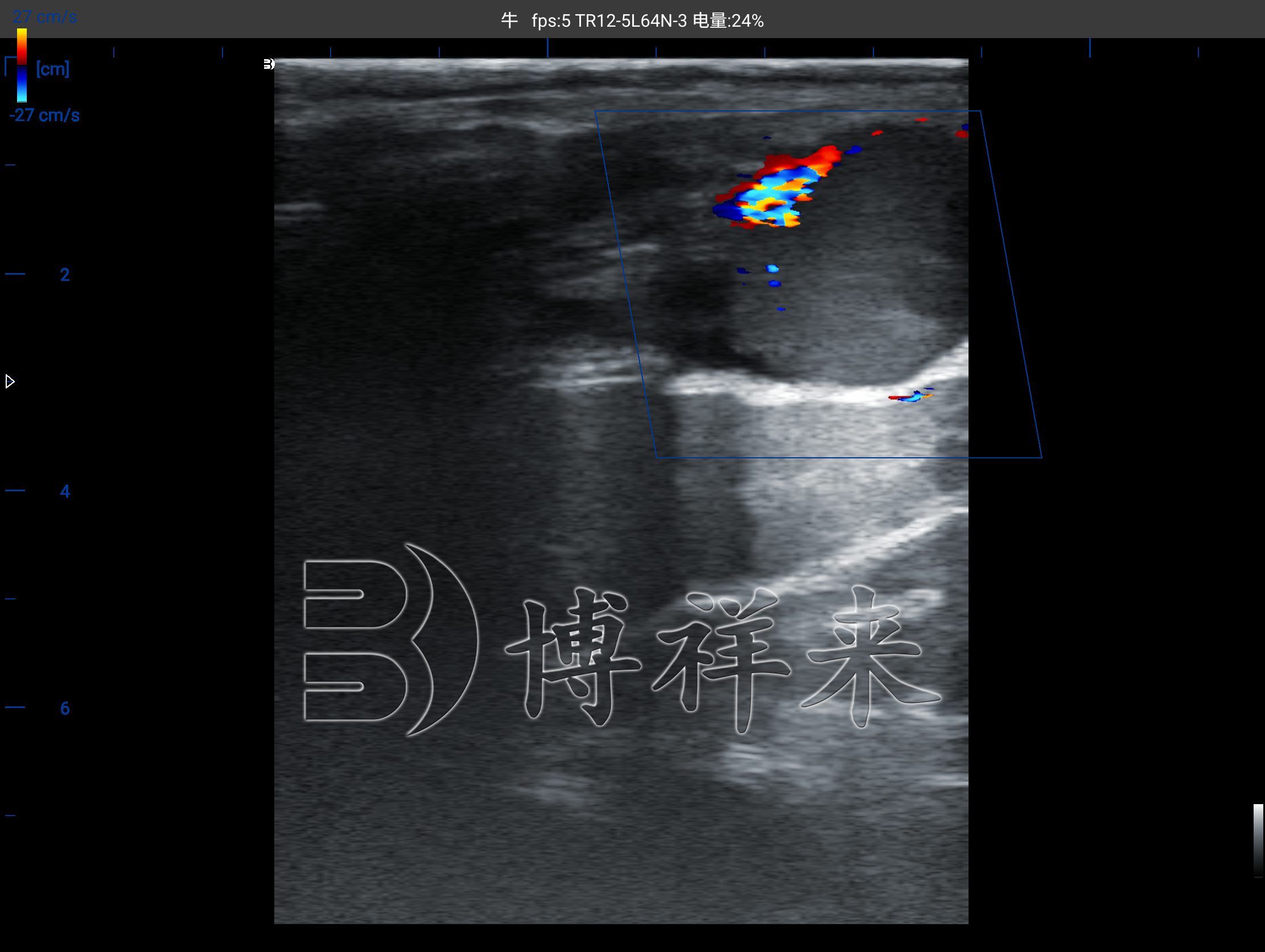 牛黄体血流超声图像 牛黄体血流超声图像