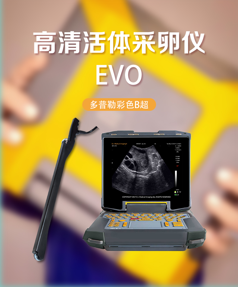 高清活体采卵B超机